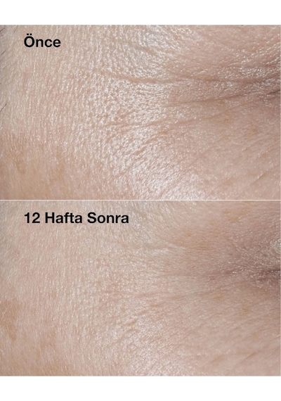 Smart Clinical Repair Spf30 Çizgi Ve Kırışıklık Görünümü Azaltıcı Yaşlanma Karşıtı Krem 50ml