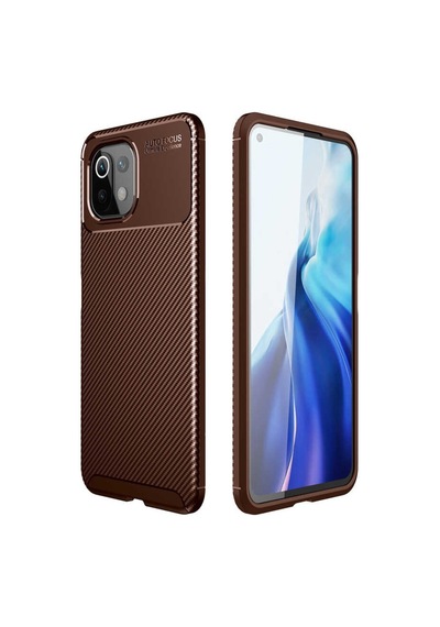 Xiaomi Mi 11 Lite Kılıf Zore Negro Karbon Tasarım Silikon Kılıf