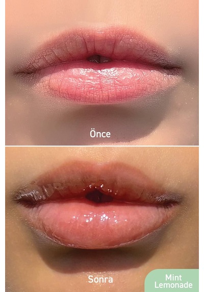 Herbaderm Limonata Aromalı Parlatıcı Dolgunlaştırıcı ve Onarıcı Vegan Dudak Balmı 10 ML