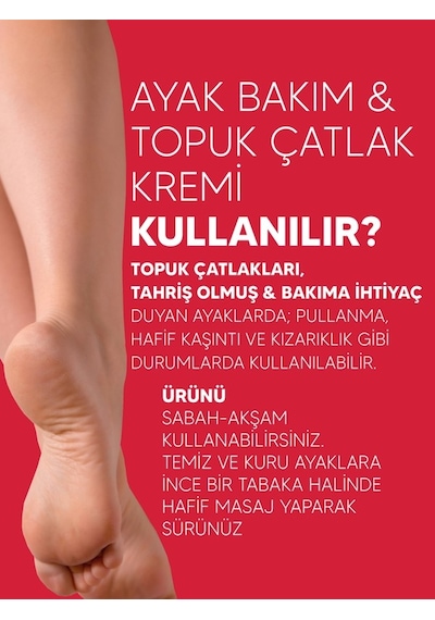 Zederma 60 Ml Ayak Bakım & Topuk Çatlak Kremi %20 Üre İle Hızlı Nemlendirme Sağlar