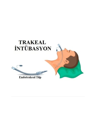 Entübasyon Tüpü Kaflı Endotrakeal Tüp Balonlu 1 Adet No:7.5