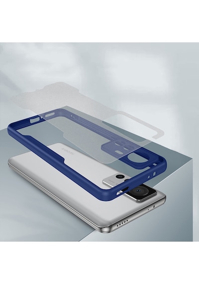 Xiaomi Mi 12t Kılıf Kamera Korumalı Arkası Mat Platin Silikon Kılıf Xiaomi Mi 12t Kılıf Kamera Korumalı Arkası Mat Platin Silikon Kılıf