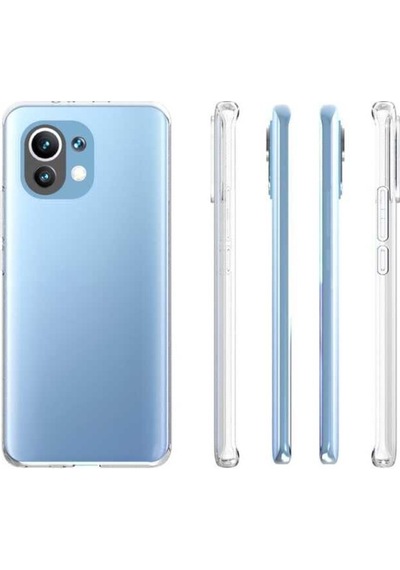 Xiaomi Mi 11 Kılıf Zore Şeffaf Ince Ve Esnek Süper Silikon Kılıf Renksiz