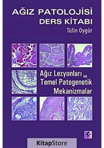 Ağız Patolojisi Ders Kitabı- Efil Yayınevi Yayınları