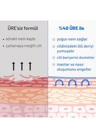Ayak Ve Topuk Çatlak Bakım Kremi%40 Üre Ve%2 Salisilik Asit Nasır, Sert Ve Ölü Deriler, Ayak Kokusu Karşıtı Nemlendirici Krem 75ml