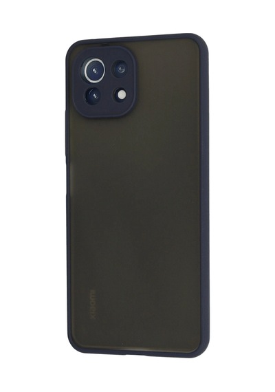 Uryport Xiaomi Mi 11 Lite Kılıf Montreal Silikon Kapak - Lacivert