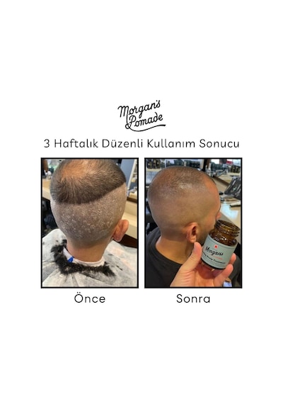 Morgan's Pomade Cooling Scalp Treatment - Kepek Karşıtı Baş Derisi Bakım 100 G