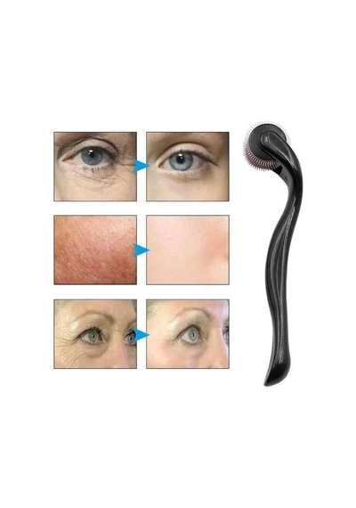 Dermaroller Titanyum 540 Iğneli 1 Mm Saç Kaş Sakal Serum Kullanıma Uygun diğer 16178804