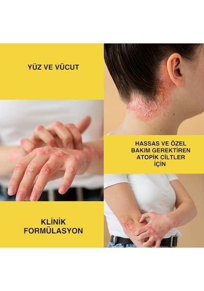Sülfax Kükürt Vücut Kremi 100ml