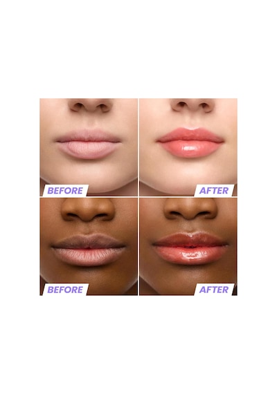 Wonderskin Lip Rehab Nemlendirici Ve Onarıcı Renkli Dudak Serumu Yağı Flirt 3.57ml