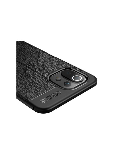 Xiaomi Mi 11 Lite Kılıf Deri Tarzı Niss Silikon Case