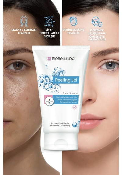 Arındırıcı Ve Siyah Nokta Temizleyici Peeling Jel 150 Ml
