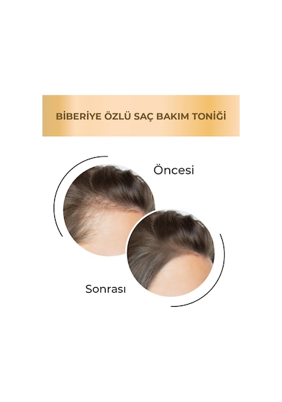 Agarta Saf Biberiye Suyu Saç Toniği Dökülme Karşıtı Ve Saç Uzamasını Destekleyici Tonik 125 ML