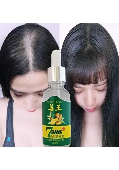 Sh 7days 30ml Gingergerminalessentialoil Hair Growth Loss Treatment Serum Unisex 3 Adet Saç Bakım Yağı Najmaddin