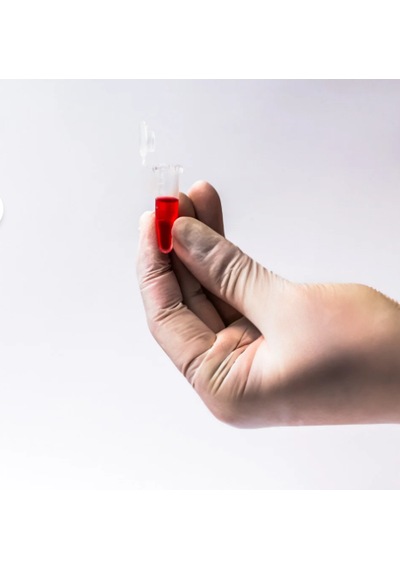 Eppendorf Tüp 1.5 Ml - 10.000 Adet