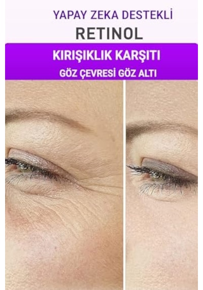 Adén Cosmetics Aydınlatıcı C Serum İle Kırışıklık Ve Lekere Son