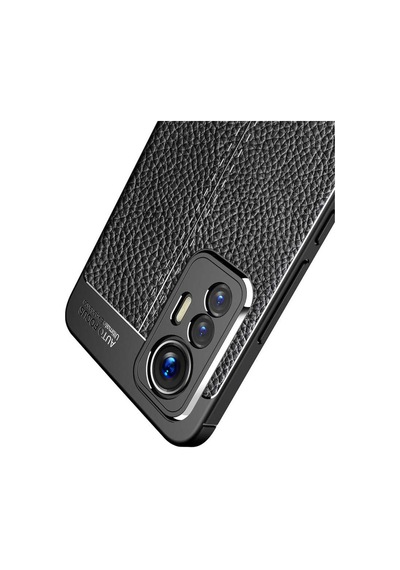 Xiaomi Mi 12 Lite Kilif Zore Niss Deri Desenli Silikon Kilif 559808065