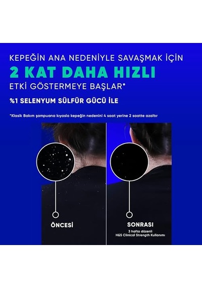 &amp Shoulders Clinical Strength Cooling Itch Rescue Kaşıntı Karşıtı Şampuan 400 Ml