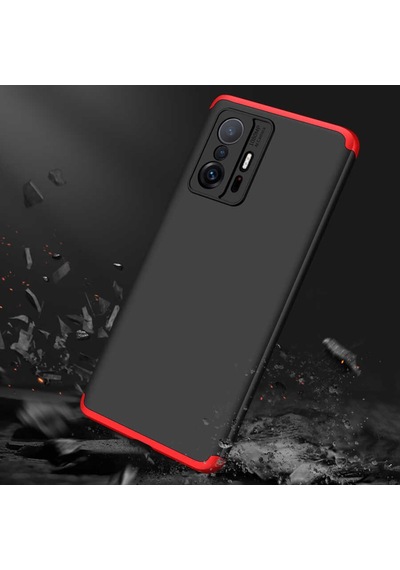 Xiaomi Mi 11T 5G Kilif Zore Ays Full Koruma Kilif 532707488
