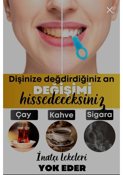 Upeka Diş Beyazlatma Kiti