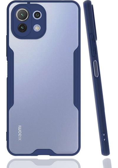 Uryport Xiaomi Mi 11 Lite Kılıf Platin Silikon - Lacivert