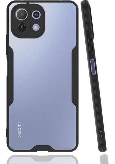 Xiaomi Mi 11 Lite Kapak Colorful Kamera Korumalı Silikon Kılıf