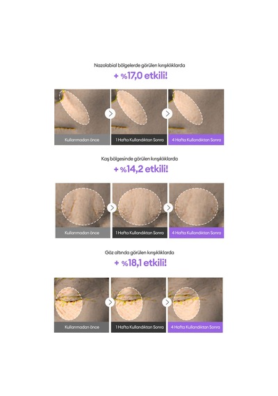 Retinol İçerikli Besleyici Ampul Time Revolution Retinol 500 Shot Ampoule