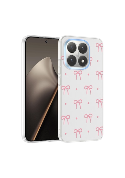 Xiaomi 15t Kılıf Çiçek Ve Fiyonk Desenli Kamera Yükseltili Celikaksesuar Premium