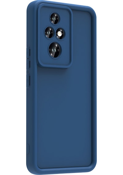 Zore Honor 200 Pro Kılıf Kamera Korumalı Ananas Kapak - Koyu Yeşil Koyu Yeşil