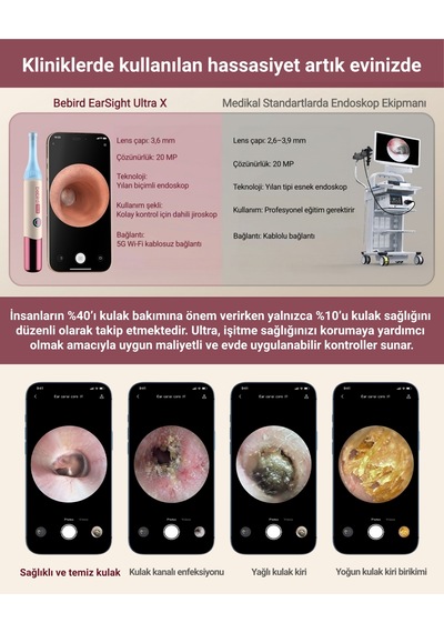 Bebird Ultra X 2k Hd Kameralı Akıllı Kulak Temizleme Ve Bakım Cihazı Hediye Kutulu