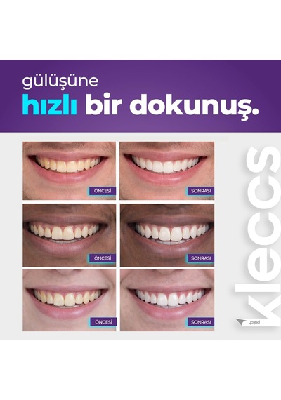 Diş Beyazlatma Bandı, Hızlı Beyazlık, 14 Paket-28 Bant, Hızlı Diş Beyazlatma Bandı, Günlük Ve Bireysel Kullanıma Uygun