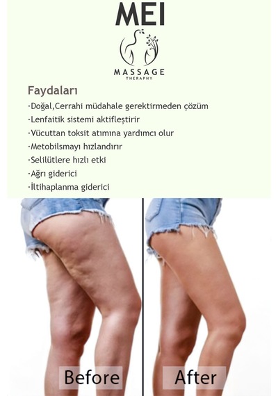 Ahşap Masaj Balık Kuyruğu Gua Sha Masajı Lenfatik Drenaj Kas Rahatlatıcı Her Noktasi Özel Uygulama Diğer