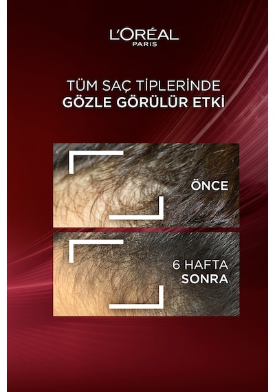 ELSEVE Komple Direnç Dökülme Karşıtı Saç Bakım Kremi 250 ml