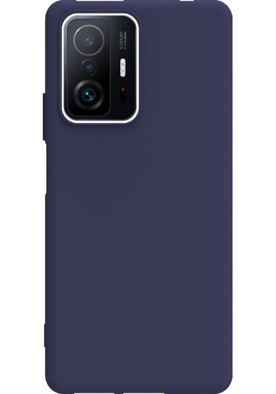 Smcase Xiaomi 11T Kılıf Biye Tpu Silikon