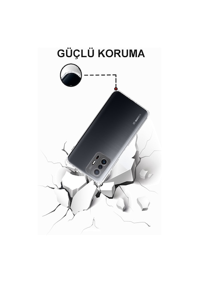 Xiaomi Mi 11T Pro 5G Tıpalı Kamera Korumalı Şeffaf Premier Kılıf