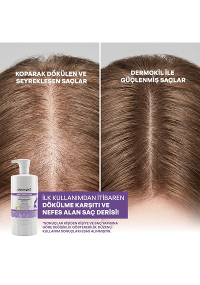 Dermokil Biotin & Caffeine Dökülme Karşıtı Şampuan 950 Ml Dökülen