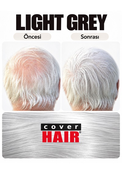 Cover Haır Orta Kahverengi Saç Fiberi 30 Gram Dolgunlaştırıcı Kellik Kapatıcı Toz Topik Tozu