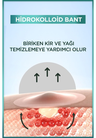 Skin Cilt Kusurlari Karşıtı Bant 12 Li