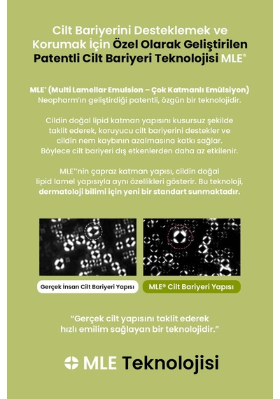 Aşırı Kuru Hassas Cilde Bariyer Desteği Sunan Yoğun Nemlendirici Krem Zeroıd Intensive Cream