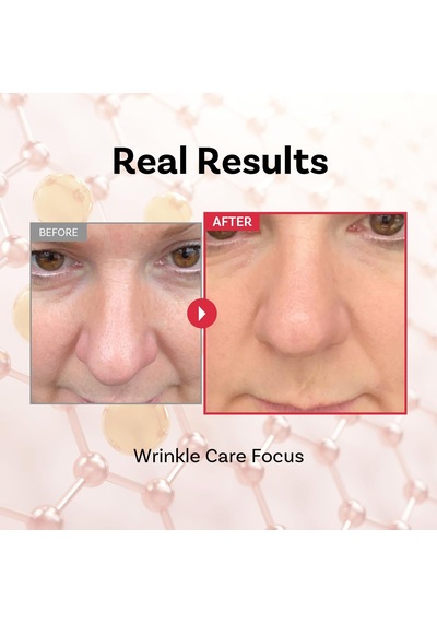 Peptide 11 Botulinum Tension Up Repair Cream 50 Ml Peptitli Sıkılaştırıcı Onarıcı Krem