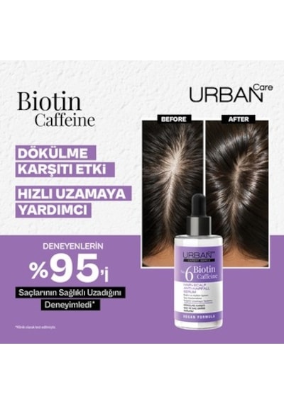 Dökülme Karşıtı Saç Bakım Şampuanı - 350 Ml Biotin Ve Kafein