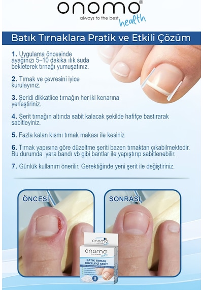 Onomo Health Batık Tırnak Düzeltme Bandı + Düzeltici Şerit Set