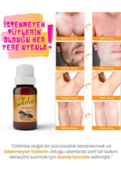 Tala Karınca Yumurtası Yağı Tüy Azaltıcı Tüy İnceltici Tüy Dökücü 20 Ml