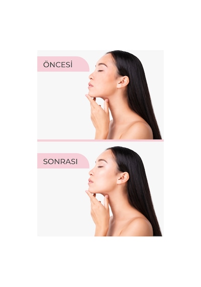 Saf Doğal Gül Suyu Tonik Sprey Gözenek Sıkılaştırıcı Aydınlatıcı Arındırıcı Yatıştırıcı Tonik