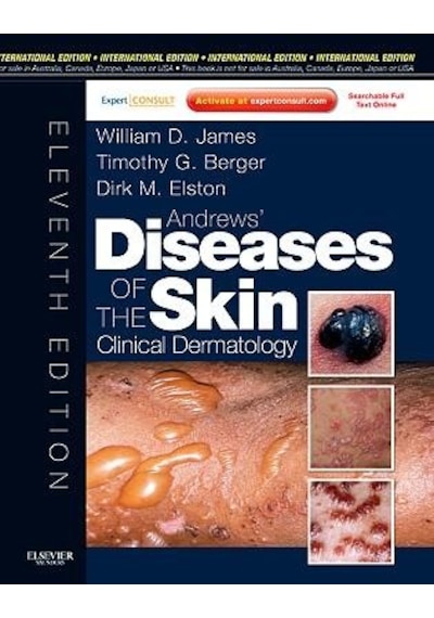 Andrew's Diseases Skin