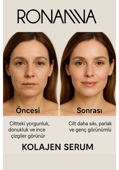 Ronanna Kolajen Serum Cilt Sıkılaştırıcı Kırışıklık Karşıtı Anti Aging Yoğun Nemlendirici Yüz Serumu 30 Ml
