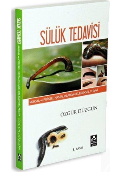 Sülük Tedavisi - Özgür Düzgün