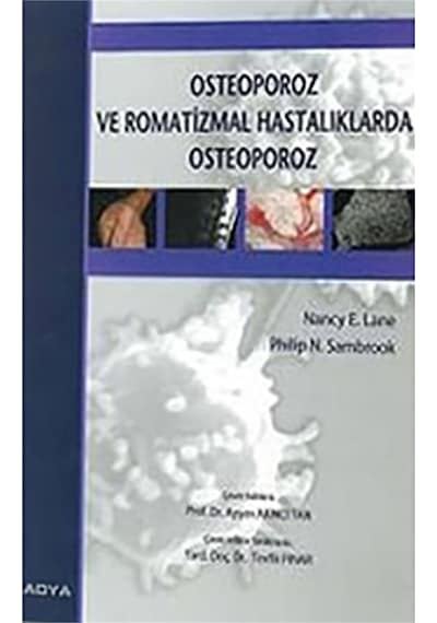 Osteoporoz Ve Romatizmal Hastalıklarda  Osteoporoz- Nobel Tıp Kitabevleri