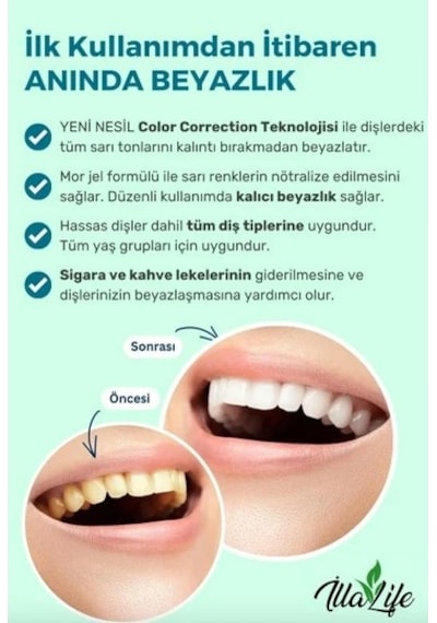İlla Life Whitening Expert Hızlı Etkili Diş Beyazlatıcı Jel 50 ML