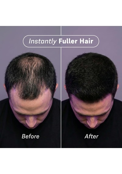 Jovica Saç Dolgunlaştırıcı Keratin Toz Fiber - Siyah Altın - Siyah